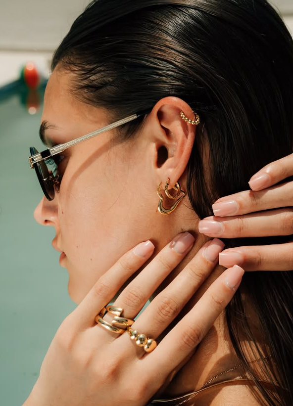 Aretes